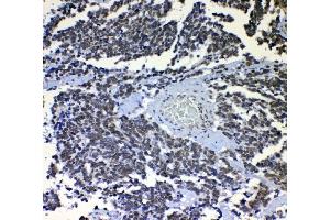 IHC analysis of nmt55/p54nrb using anti-nmt55/p54nrb antibody (ABIN3044530).