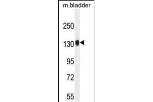 TDRD7 Antibody (C-term) (ABIN654935 and ABIN2844578) western blot analysis in mouse bladder tissue lysates (35 μg/lane). (TDRD7 anticorps  (C-Term))