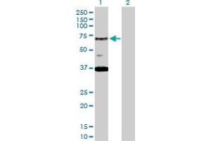 Western Blot analysis of RAD17 expression in transfected 293T cell line by RAD17 MaxPab polyclonal antibody.