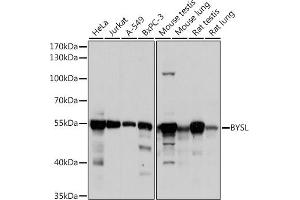 Western blot analysis of extracts of various cell lines, using BYSL antibody (ABIN6129546, ABIN6137672, ABIN6137674 and ABIN6215553) at 1:1000 dilution. (Bystin-Like anticorps  (AA 120-280))