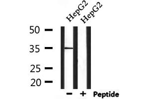 Western blot analysis of extracts from HepG2, using MSHR Antibody. (MC1 Receptor anticorps  (C-Term))