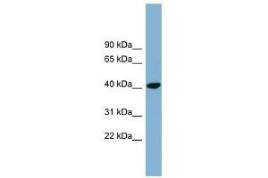 PINX1 antibody used at 1 ug/ml to detect target protein. (PINX1 anticorps  (N-Term))
