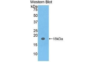 Western Blotting (WB) image for anti-Carcinoembryonic Antigen Gene Family (CEA) antibody (Biotin) (ABIN1172455) (CEA anticorps  (Biotin))