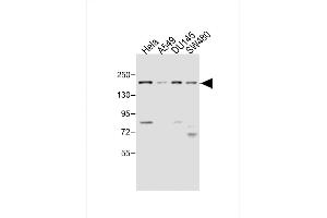 All lanes : Anti-MED14 Antibody (Center) at 1:4000 dilution Lane 1: Hela whole cell lysate Lane 2: A549 whole cell lysate Lane 3: D whole cell lysate Lane 4: S whole cell lysate Lysates/proteins at 20 μg per lane. (MED14 anticorps  (AA 586-615))
