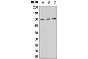 Western blot analysis of ATP1A1 expression in HeLa (A), A549 (B), HepG2 (C) whole cell lysates.
