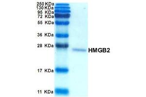 SDS-PAGE with Coomassie Blue Staining (HMGB2 Protéine)
