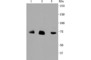 Lane 1: JAR lysates, Lane 2: HUVEC lysates, Lane 3: Hela lysates probed with Alas1 (1G11) Monoclonal Antibody  at 1:1000. (ALAS1 anticorps)