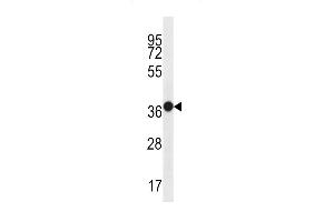 MUC15 Antibody (C-term) (ABIN656956 and ABIN2846141) western blot analysis in WiDr cell line lysates (35 μg/lane).
