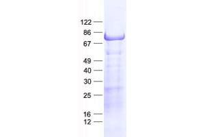 Validation with Western Blot (CCDC27 Protein (His tag))