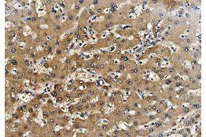 IHC analysis of Proteasome 20S Beta 7/PSMB7 using anti-Proteasome 20S Beta 7/PSMB7 antibody (ABIN7600256).