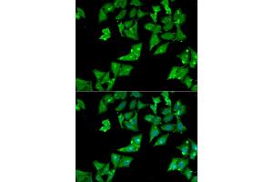 Immunofluorescence analysis of HeLa cells using AGA antibody (ABIN5973763). (AGA anticorps)