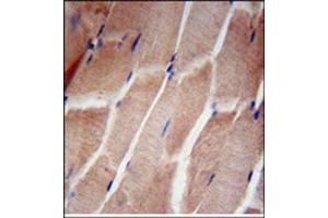 Immunohistochemistry analysis in Formalin Fixed, Paraffin Embedded Human skeletal muscle using RPL5 Antibody (N-term) followed by peroxidase conjugation of the secondary antibody and DAB staining. (RPL5 anticorps  (N-Term))