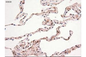 Image no. 4 for anti-Myc Proto-Oncogene protein (MYC) antibody (ABIN1497013) (c-MYC anticorps)