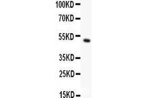 Anti- CD146 antibody, Western blotting All lanes: Anti CD146  at 0. (MCAM anticorps  (AA 59-401))