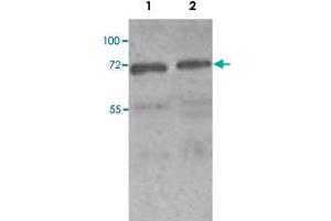 Western blot analysis of HeLa (Lane 1) and MCF-7 (Lane 2) cell lysate with PAK4 polyclonal antibody  at 1 : 250 dilution. (PAK4 anticorps  (N-Term))
