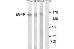 Western Blotting (WB) image for anti-Epidermal Growth Factor Receptor (EGFR) (AA 1036-1085) antibody (ABIN2889086) (EGFR anticorps  (AA 1036-1085))