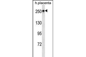 SCRIB Antibody (N-term) (ABIN1539341 and ABIN2850259) western blot analysis in human placenta tissue lysates (35 μg/lane). (SCRIB anticorps  (N-Term))