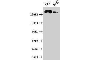 Western Blot Positive WB detected in: Raji whole cell lysate, K562 whole cell lysate All lanes: ATR antibody at 1:2000 Secondary Goat polyclonal to rabbit IgG at 1/50000 dilution Predicted band size: 302, 295, 298 kDa Observed band size: 302 kDa (ATR anticorps  (AA 2405-2644))