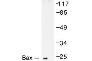 Image no. 2 for anti-BCL2-Associated X Protein (BAX) antibody (ABIN265325) (BAX anticorps)
