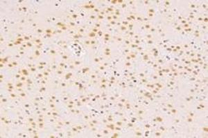 Immunohistochemistry analysis of paraffin-embedded rat tsubstantia nigra using SUN2 (ABIN7075502) at dilution of 1: 4000 (SUN2 anticorps)