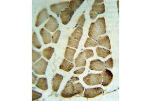 RVA Antibody (C-term) (ABIN653266 and ABIN2842784) IHC analysis in formalin fixed and raffin embedded human skeletal muscle tissue followed by peroxidase conjugation of the secondary antibody and DAB staining.