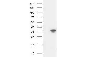 Western Blotting (WB) image for anti-Cyclin-Dependent Kinase 2 (CDK2) antibody (ABIN1497397) (CDK2 anticorps)