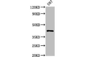 Western Blot Positive WB detected in: U87 whole cell lysate All lanes: PRKAR1A antibody at 1. (Recombinant PRKAR1A anticorps)