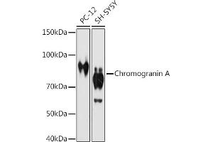 Western blot analysis of extracts of various cell lines, using Chromogranin A antibody (ABIN7266366) at 1:1000 dilution. (Chromogranin A anticorps)