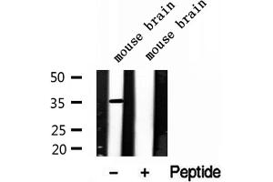 Western blot analysis of extracts of mouse brain tissue, using LDHB antibody. (LDHB anticorps  (N-Term))