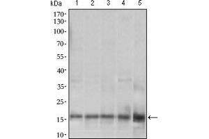 Western blot analysis using MRPL42 mouse mAb against HL7702 (1), SMMC-7721 (2), HEK293 (3) , HeLa (4) and Raji (5) cell lysate. (MRPL42 anticorps  (AA 10-142))