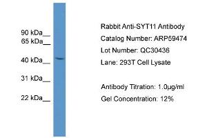 WB Suggested Anti-SYT11  Antibody Titration: 0.