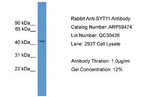 WB Suggested Anti-SYT11  Antibody Titration: 0. (SYT11 anticorps  (N-Term))