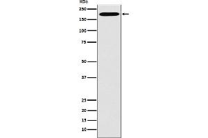 Western blot analysis of Clathrin heavy chain expression in Hela cell lysate.