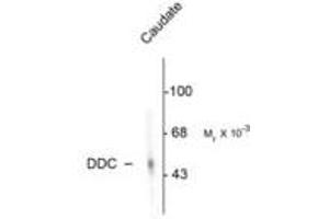 Image no. 1 for anti-Dopa Decarboxylase (Aromatic L-Amino Acid Decarboxylase) (DDC) antibody (ABIN220954) (DDC anticorps)