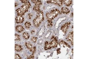 Immunohistochemical staining (Formalin-fixed paraffin-embedded sections) of human kidney with SLC22A11 polyclonal antibody  shows distinct membranous positivity in tubular cells.