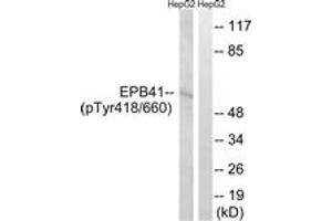 Western blot analysis of extracts from HepG2 cells treated with PMA 125ng/ml 30', using EPB41 (Phospho-Tyr660/418) Antibody. (EPB41 anticorps  (pTyr660))
