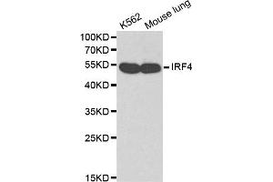 Western blot analysis of K562 cell lines and mouse lung using IRF4 antibody. (IRF4 anticorps)