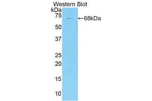 Western Blotting (WB) image for anti-Collagen, Type XVIII (COL18) (AA 1072-1271) antibody (ABIN1858450) (COL18 anticorps  (AA 1072-1271))