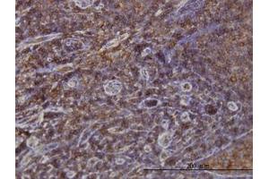 Image no. 1 for anti-Sorting Nexin 1 (SNX1) (AA 166-276) antibody (ABIN598935) (Sorting Nexin 1 anticorps  (AA 166-276))