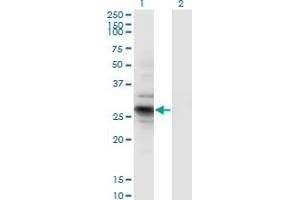 Western Blot analysis of IDI2 expression in transfected 293T cell line by IDI2 monoclonal antibody (M01), clone 1C11. (IPP Isomerase 2 anticorps  (AA 1-227))