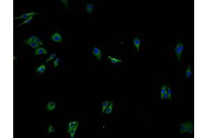 Immunofluorescence staining of HepG2 cells with ABIN7139976 at 1:100, counter-stained with DAPI.