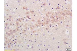 Formalin-fixed and paraffin embedded rat brain labeled with Rabbit Anti Annexin A13 Polyclonal Antibody, Unconjugated (ABIN724250) at 1:200 followed by conjugation to the secondary antibody and DAB staining (ARTN anticorps  (AA 101-170))