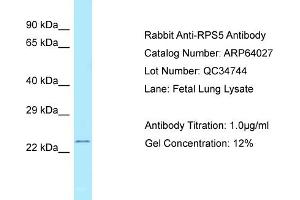Western Blotting (WB) image for anti-Ribosomal Protein S5 (RPS5) (C-Term) antibody (ABIN2789702) (RPS5 anticorps  (C-Term))