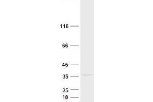 Validation with Western Blot