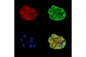 ABIN7095528 and ABIN7099585 staining Hela cells by IF/ICC.