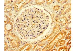 Immunohistochemistry of paraffin-embedded human kidney tissue using ABIN7171701 at dilution of 1:100 (TTI1 anticorps  (AA 692-858))