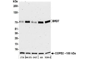 Western Blotting (WB) image for anti-Bromodomain Containing 7 (BRD7) (AA 150-200) antibody (ABIN7449350) (Recombinant BRD7 anticorps  (AA 150-200))