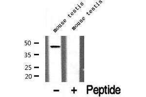 Western blot analysis of extracts of mouse testis tissue, using ADRM1 antibody. (ADRM1 anticorps  (Internal Region))