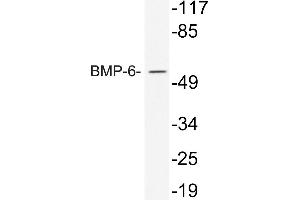 Western blot (WB) analysis of BMP-6 antibody in extracts from 293 cells treated with TNF. (BMP6 anticorps)