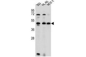 ANKRD40 Antibody (C-term) western blot analysis in 293,HL-60,MCF-7 cell line lysates (35µg/lane). (ANKRD40 anticorps  (C-Term))